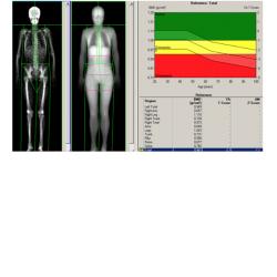 Sports Physiology: Optimizing the Human Machine!